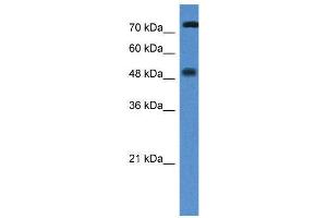 WB Suggested Anti-VDR AntibodyTitration: 1. (Vitamin D Receptor Antikörper  (N-Term))