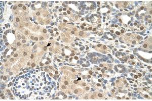 Rabbit Anti-TMEM30A Antibody  Paraffin Embedded Tissue: Human Kidney Cellular Data: Epithelial cells of renal tubule Antibody Concentration: 4. (TMEM30A Antikörper  (Middle Region))