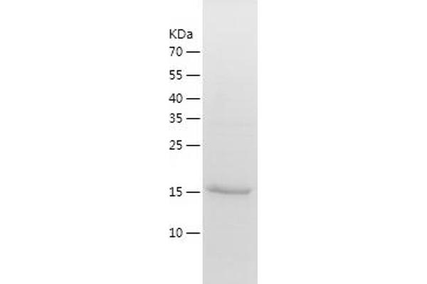 HBXIP Protein (AA 1-173) (His tag)