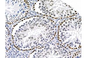 ABIN6263585 and ABIN6277242 at 1/100 staining Mouse testis tissue by IHC-P.