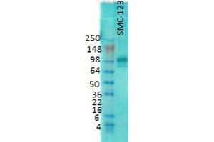 western rat membrane 1 in 1000 PSD 95. (DLG4 Antikörper)