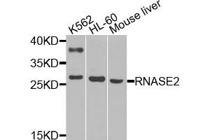 Western blot analysis of extracts of various cells, using RNASE2 antibody. (RNASE2 Antikörper)
