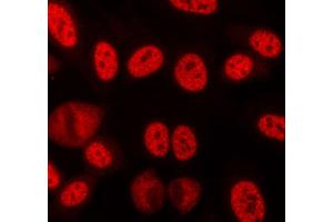ABIN6268709 staining lovo cells by ICC/IF. (Lamin B Antikörper)