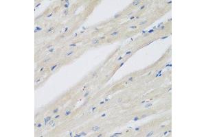 Immunohistochemistry (Paraffin-embedded Sections) (IHC (p)) image for anti-N(alpha)-Acetyltransferase 50, NatE Catalytic Subunit (NAA50) (AA 1-169) antibody (ABIN6144326)