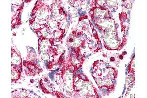 Anti-INHA / Inhibin Alpha antibody IHC of human placenta. (Inhibin alpha Antikörper)