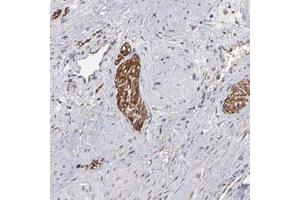 Immunohistochemical staining (Formalin-fixed paraffin-embedded sections) of human prostate with CHL1 polyclonal antibody  shows strong positivity in peripheral nerves at 1:200-1:500 dilution.