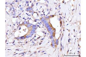IHC analysis of GIGYF2 using anti-GIGYF2 antibody (ABIN7601679).