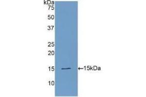 Detection of Recombinant PLAA, Human using Polyclonal Antibody to Phospholipase A2 Activating Protein (PLAP)