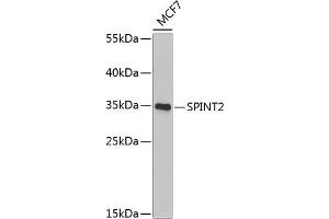 Western blot analysis of extracts of MCF-7 cells, using SPINT2 Antibody (ABIN6132838, ABIN6148361, ABIN6148362 and ABIN6222480) at 1:1000 dilution. (SPINT2 Antikörper  (AA 28-197))