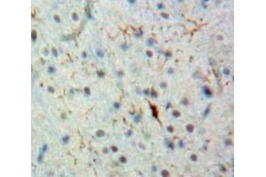 IHC-P analysis of Brain tissue, with DAB staining. (BCL9 Antikörper  (AA 1118-1327))