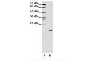 Image no. 1 for anti-Double Homeobox 5 (DUX5) (C-Term) antibody (ABIN203019) (DUX5 Antikörper  (C-Term))