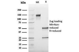 SDS-PAGE Analysis Purified Cathepsin K Mouse Monoclonal Antibody (CTSK/2793).