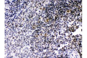 Anti- RAG2 Picoband antibody, IHC(P) IHC(P): Rat Spleen Tissue (RAG2 Antikörper  (C-Term))