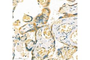 Immunohistochemistry of paraffin embedded human placenta using LOXL4 (ABIN7074541) at dilution of 1:400 (400x lens) (LOXL4 Antikörper)