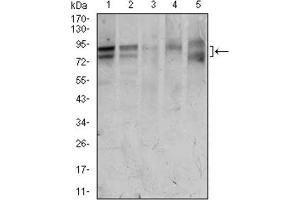 Western Blotting (WB) image for anti-Forkhead Box P1 (FOXP1) (AA 481-677) antibody (ABIN1845854) (FOXP1 Antikörper  (AA 481-677))