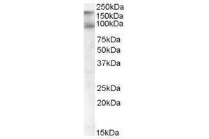 Image no. 2 for anti-CUB Domain Containing Protein 1 (CDCP1) (C-Term), (Isoform 1) antibody (ABIN374144) (CDCP1 Antikörper  (C-Term, Isoform 1))