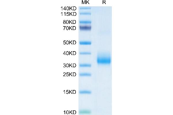OLR1 Protein (AA 61-273) (His tag)