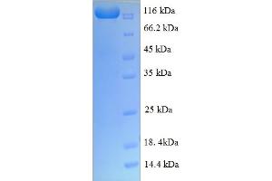 SDS-PAGE (SDS) image for Nuclear Factor of kappa Light Polypeptide Gene Enhancer in B-Cells 1 (NFKB1) (AA 1-961), (partial) protein (GST tag) (ABIN5712728)