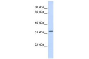 Image no. 1 for anti-Aprataxin (APTX) (AA 108-157) antibody (ABIN6742328) (Aprataxin Antikörper  (AA 108-157))