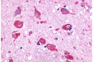 Anti-GPR150 antibody  ABIN1048734 IHC staining of human brain, neurons and glia.