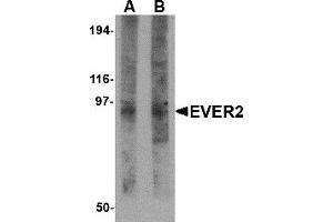 Western Blotting (WB) image for anti-Transmembrane Channel-Like 8 (TMC8) (N-Term) antibody (ABIN1031376) (TMC8 Antikörper  (N-Term))