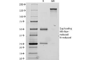 SDS-PAGE Analysis Purified Thyroglobulin Mouse Monoclonal Antibody (TGB24). (Thyroglobulin Antikörper)