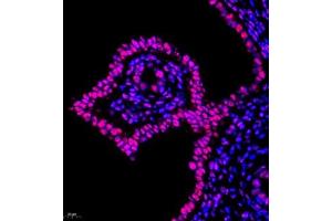 Immunofluorescence of paraffin embedded rat uterus using Skar (ABIN7074970) at dilution of 1:950 (400x lens) (p46 Antikörper)