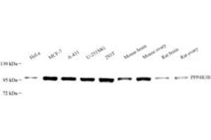 Western blot analysis of SMEK2 (ABIN7074520),at dilution of 1: 3000 (SMEK2 Antikörper)