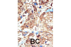 Immunohistochemistry (IHC) image for anti-EPH Receptor B1 (EPHB1) antibody (ABIN3003344)