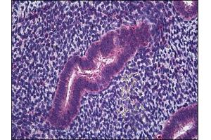Human Uterus, Endometrium: Formalin-Fixed, Paraffin-Embedded (FFPE) (IFITM1 Antikörper)