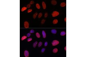 Immunofluorescence analysis of U-2 OS cells using SUN2 antibody (ABIN7270136) at dilution of 1:100. (SUN2 Antikörper)
