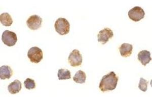 Immunocytochemistry of BTK in Daudi cells with AP30170PU-N BTK antibody at 10 μg/ml.