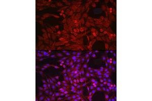 Immunofluorescence analysis of PC-12 cells using  Rabbit pAb (ABIN3015338, ABIN3015339, ABIN5663782 and ABIN6213995) at dilution of 1:50 (40x lens). (ADAM17 Antikörper  (C-Term))