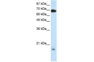 WB Suggested Anti-TRIM32 Antibody Titration: 0. (TRIM32 Antikörper  (C-Term))