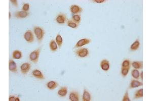 Immunocytochemistry analysis of ABIN7139181 diluted at 1:20 and staining in Hela cells (treated with 30mM sodium butyrate for 4h) performed on a Leica BondTM system. (H2AFZ Antikörper  (acLys4))