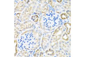 Immunohistochemistry of paraffin-embedded mouse kidney using TIRAP antibody (ABIN6292427) at dilution of 1:100 (40x lens).
