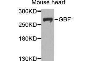 Western blot analysis of extracts of mouse heart, using GBF1 antibody. (GBF1 Antikörper)
