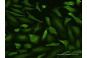Immunofluorescence (IF) image for anti-Mucosa Associated Lymphoid Tissue Lymphoma Translocation Gene 1 (MALT1) (AA 1-813) antibody (ABIN949005)