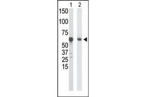 Western Blotting (WB) image for anti-Glucokinase (Hexokinase 4) (GCK) (N-Term) antibody (ABIN5552277) (GCK Antikörper  (N-Term))