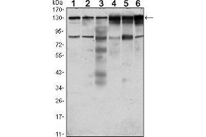 Western blot analysis using PTK7 mouse mAb against Hela (1), A431 (2), HCT116 (3), Caco2 (4), HepG2 (5) and MCF-7 (6) cell lysate.