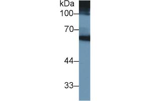 Western Blotting (WB) image for anti-Matrix Metallopeptidase 3 (Stromelysin 1, Progelatinase) (MMP3) (AA 363-477) antibody (ABIN7427837)