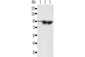 Gel: 10 % SDS-PAGE, Lysate: 60 μg, Lane 1-3: A549 cells, lncap cells, human seminoma tissue, Primary antibody: ABIN7192627(SPATA20 Antibody) at dilution 1/1000, Secondary antibody: Goat anti rabbit IgG at 1/8000 dilution, Exposure time: 5 minutes (SPATA2 Antikörper)