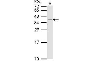 WB Image Sample (30 ug of whole cell lysate) A: H1299 12% SDS PAGE antibody diluted at 1:1000 (HLA-DR Antikörper  (Center))