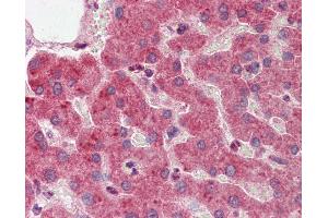 Immunohistochemistry (IHC) image for anti-14-3-3 zeta (YWHAZ) (Middle Region) antibody (ABIN2783207) (14-3-3 zeta Antikörper  (Middle Region))