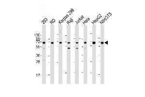 All lanes : Anti-IGF2BP1 Antibody (C-term) at 1:2000 dilution Lane 1: 293 whole cell lysate Lane 2: RD whole cell lysate Lane 3: Karpas 299 whole cell lysate Lane 4: Raji whole cell lysate Lane 5: Jurkat whole cell lysate Lane 6: Hela whole cell lysate Lane 7: HepG2 whole cell lysate Lane 8: NIH/3T3 whole cell lysate Lysates/proteins at 20 μg per lane. (IGF2BP1 Antikörper  (C-Term))