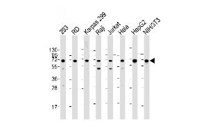All lanes : Anti-IGF2BP1 Antibody (C-term) at 1:2000 dilution Lane 1: 293 whole cell lysate Lane 2: RD whole cell lysate Lane 3: Karpas 299 whole cell lysate Lane 4: Raji whole cell lysate Lane 5: Jurkat whole cell lysate Lane 6: Hela whole cell lysate Lane 7: HepG2 whole cell lysate Lane 8: NIH/3T3 whole cell lysate Lysates/proteins at 20 μg per lane.