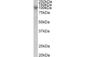 Western Blotting (WB) image for anti-ADAM Metallopeptidase Domain 8 (ADAM8) antibody (ABIN5911617) (ADAM8 Antikörper)