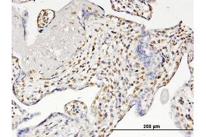 Immunoperoxidase of monoclonal antibody to RUNX2 on formalin-fixed paraffin-embedded human placenta. (RUNX2 Antikörper  (AA 251-350))
