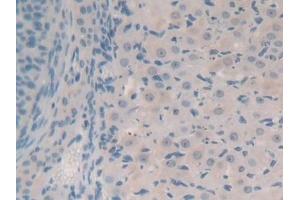 Detection of SYN1 in Mouse Ovary Tissue using Polyclonal Antibody to Synapsin I (SYN1) (SYN1 Antikörper  (AA 113-420))