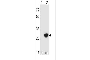 Western blot analysis of TPI1 (arrow) using rabbit polyclonal TPI1 Antibody (N-term) (ABIN389457 and ABIN2839524). (TPI1 Antikörper  (N-Term))